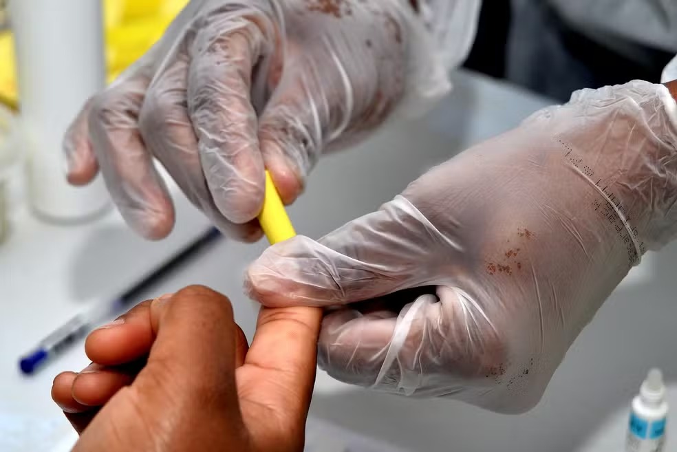Dia D de combate às hepatites virais amplia oferta de testes rápidos e orientações em Salvador